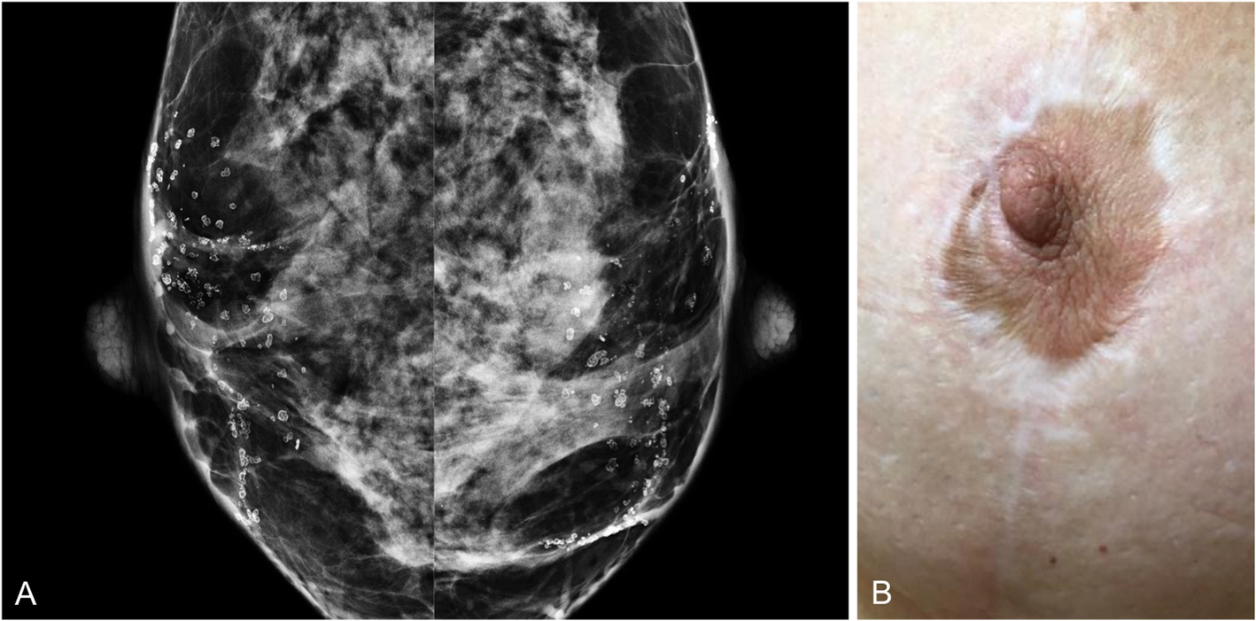 Fig. 10