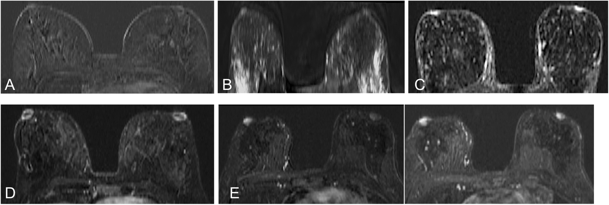 Fig. 12