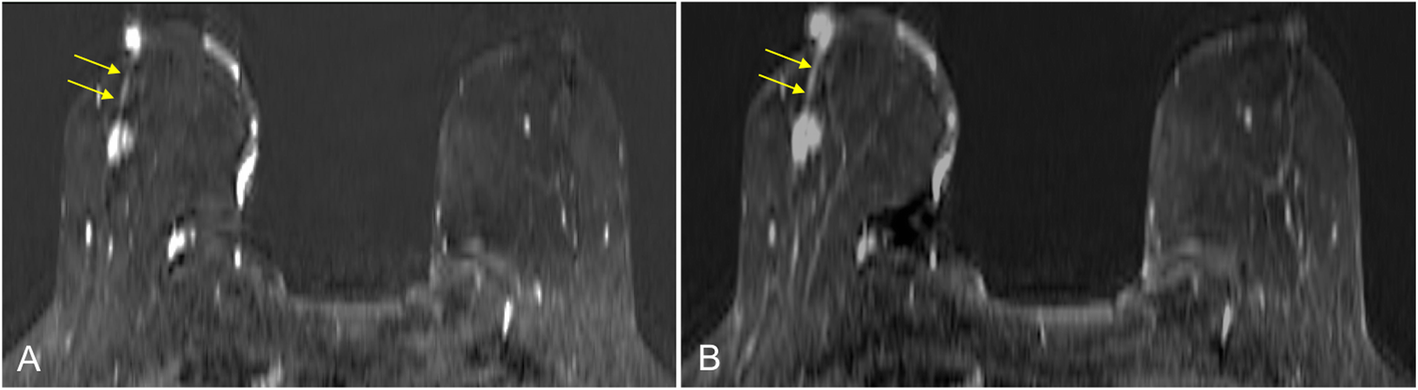 Fig. 13