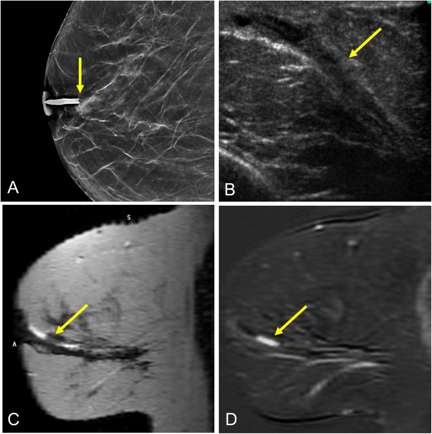 Fig. 16