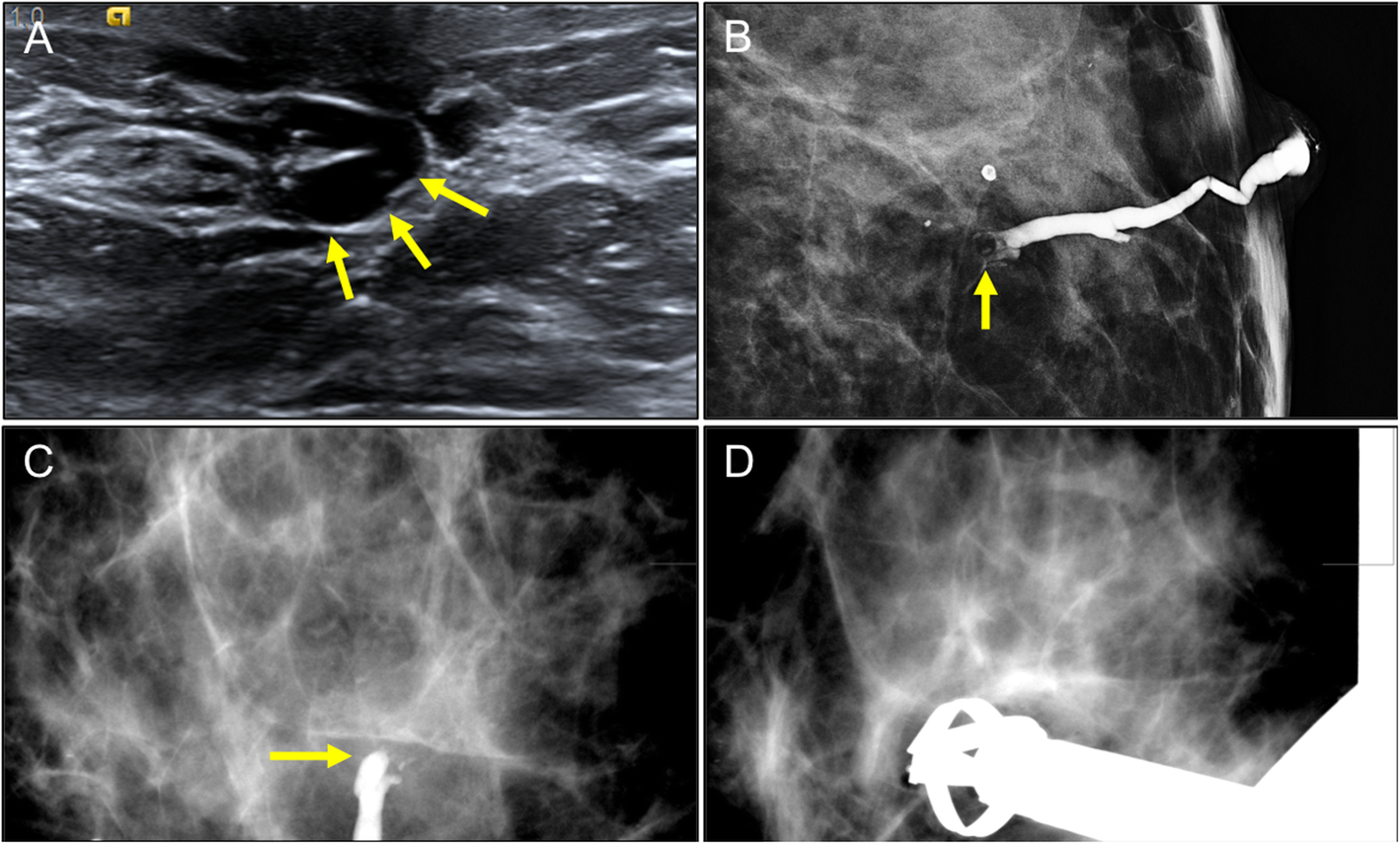 Fig. 17