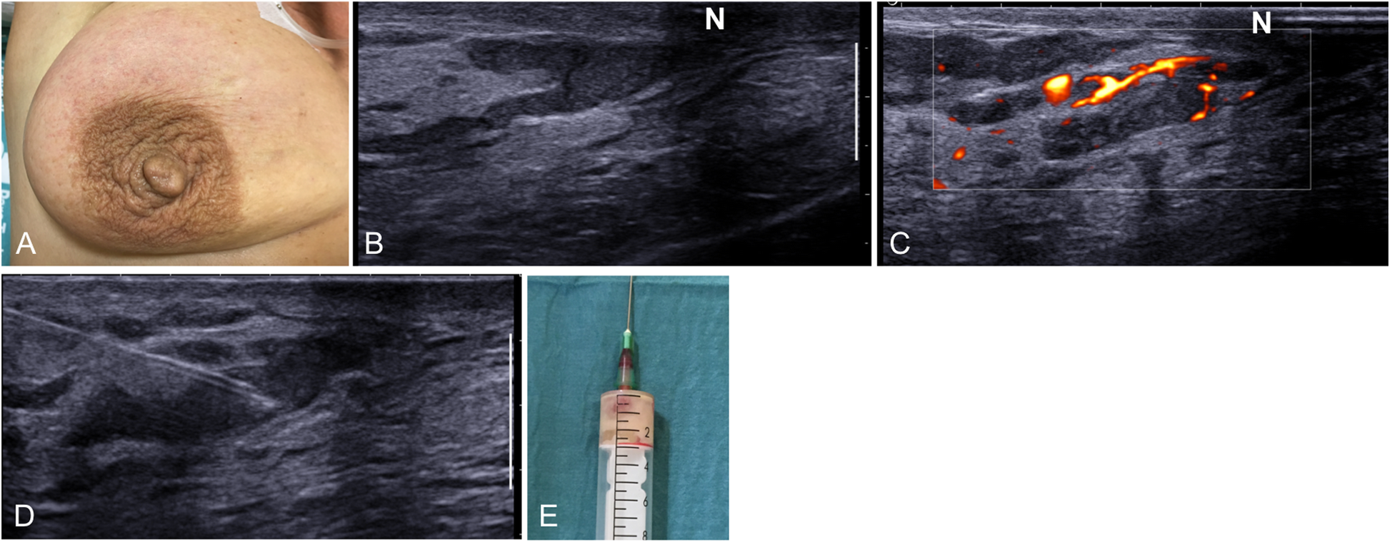 Fig. 21