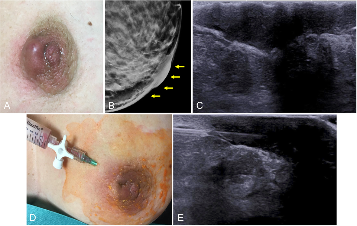 Fig. 22