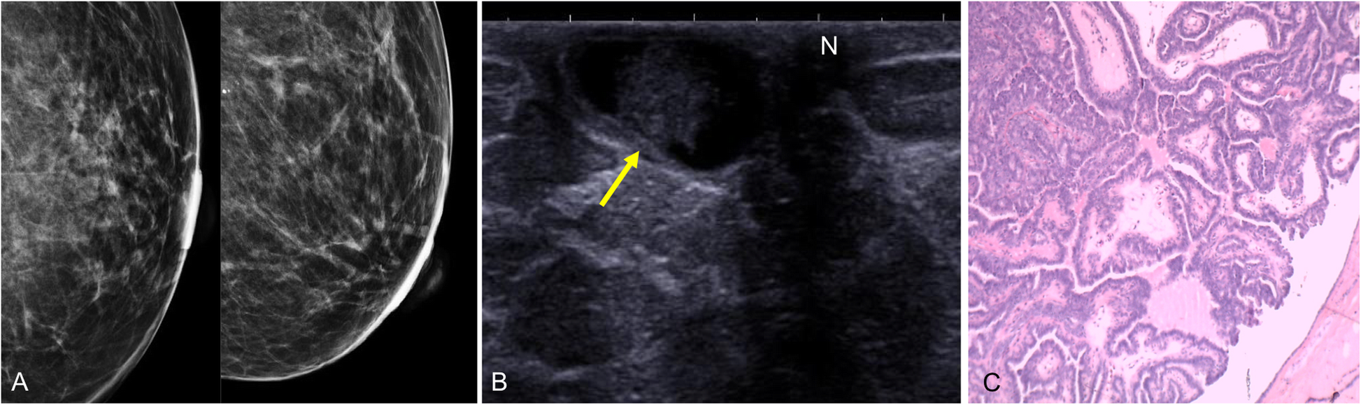 Fig. 24