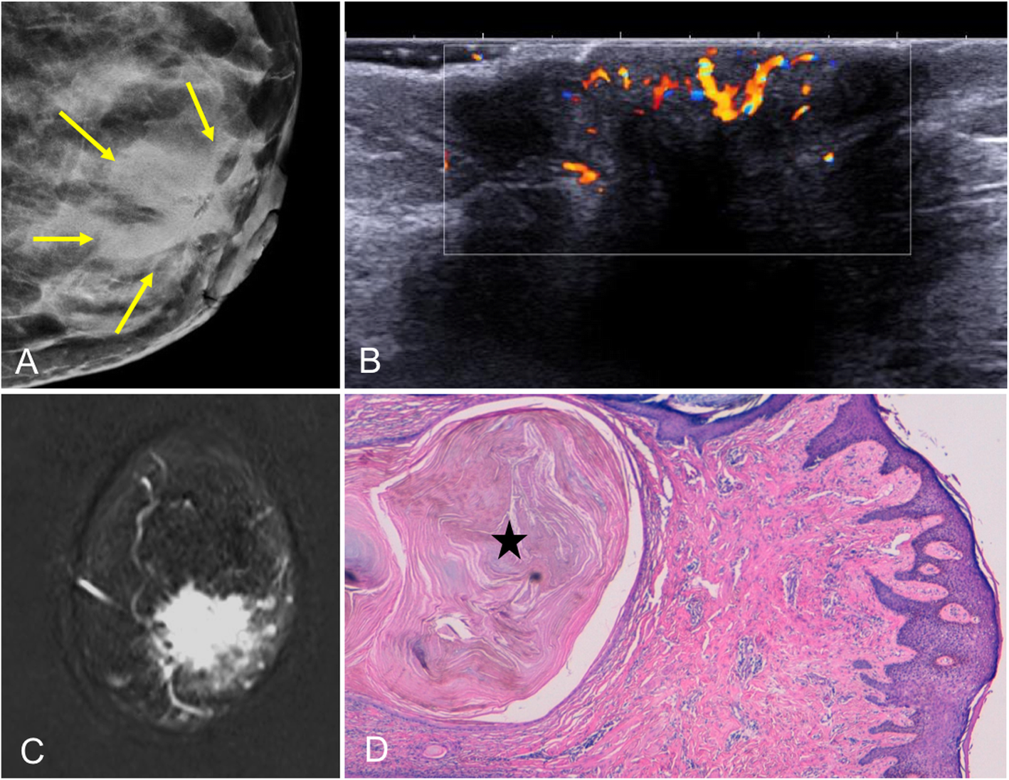 Fig. 27