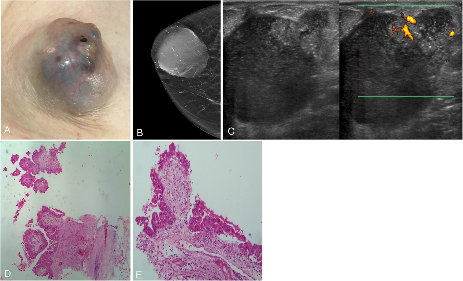 Fig. 34