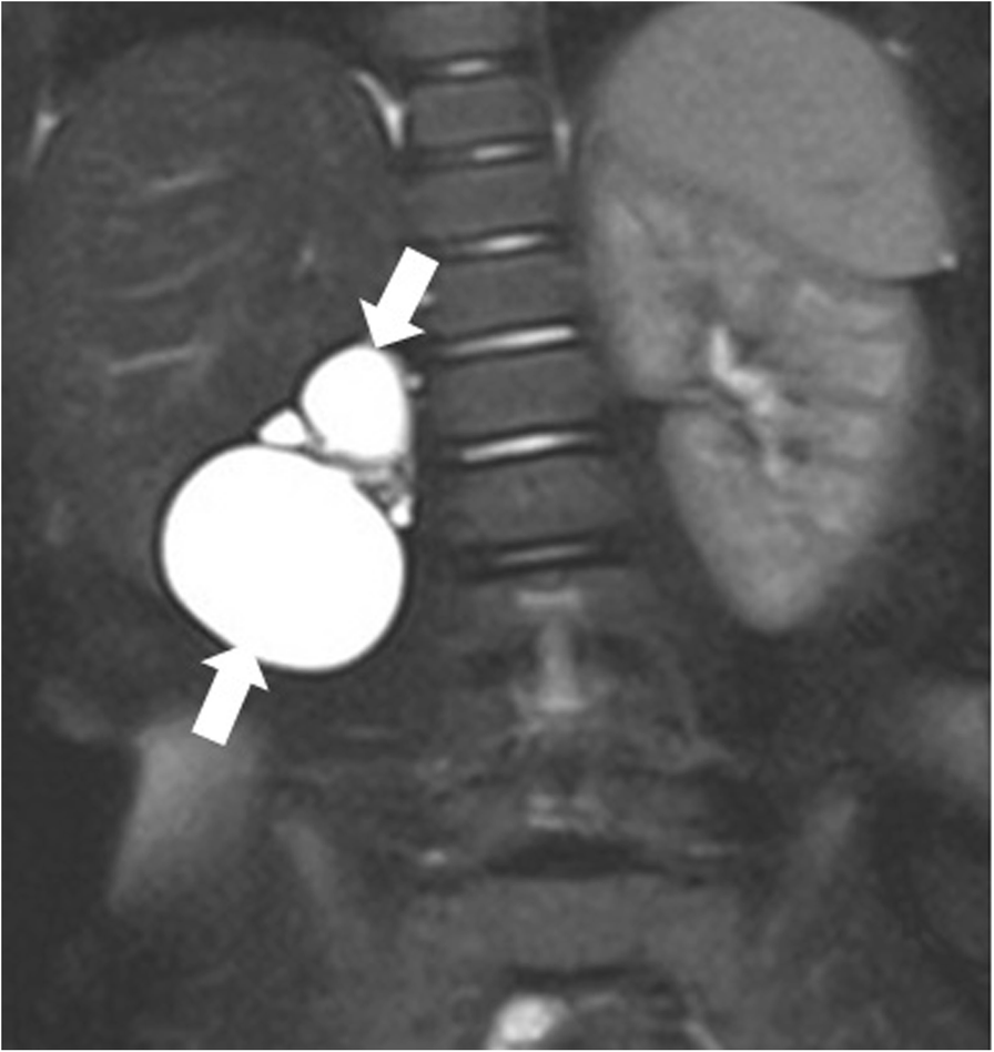 Fig. 19