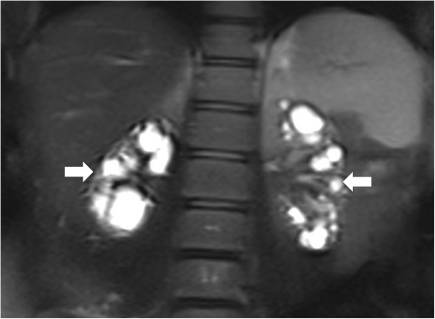 Fig. 20