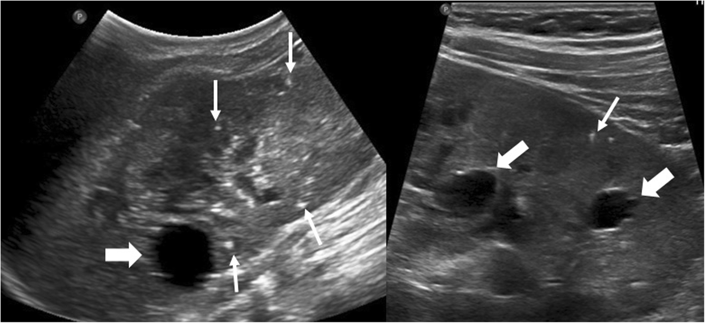 Fig. 22