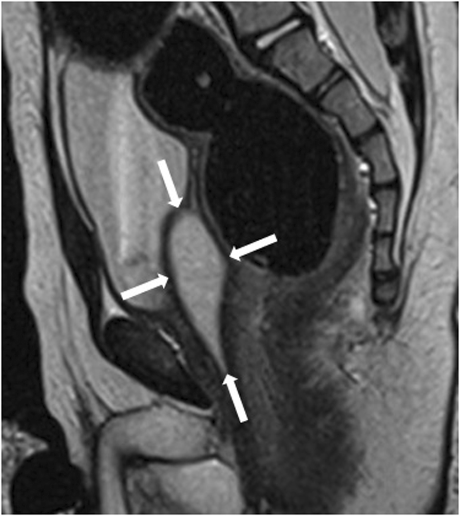 Fig. 35