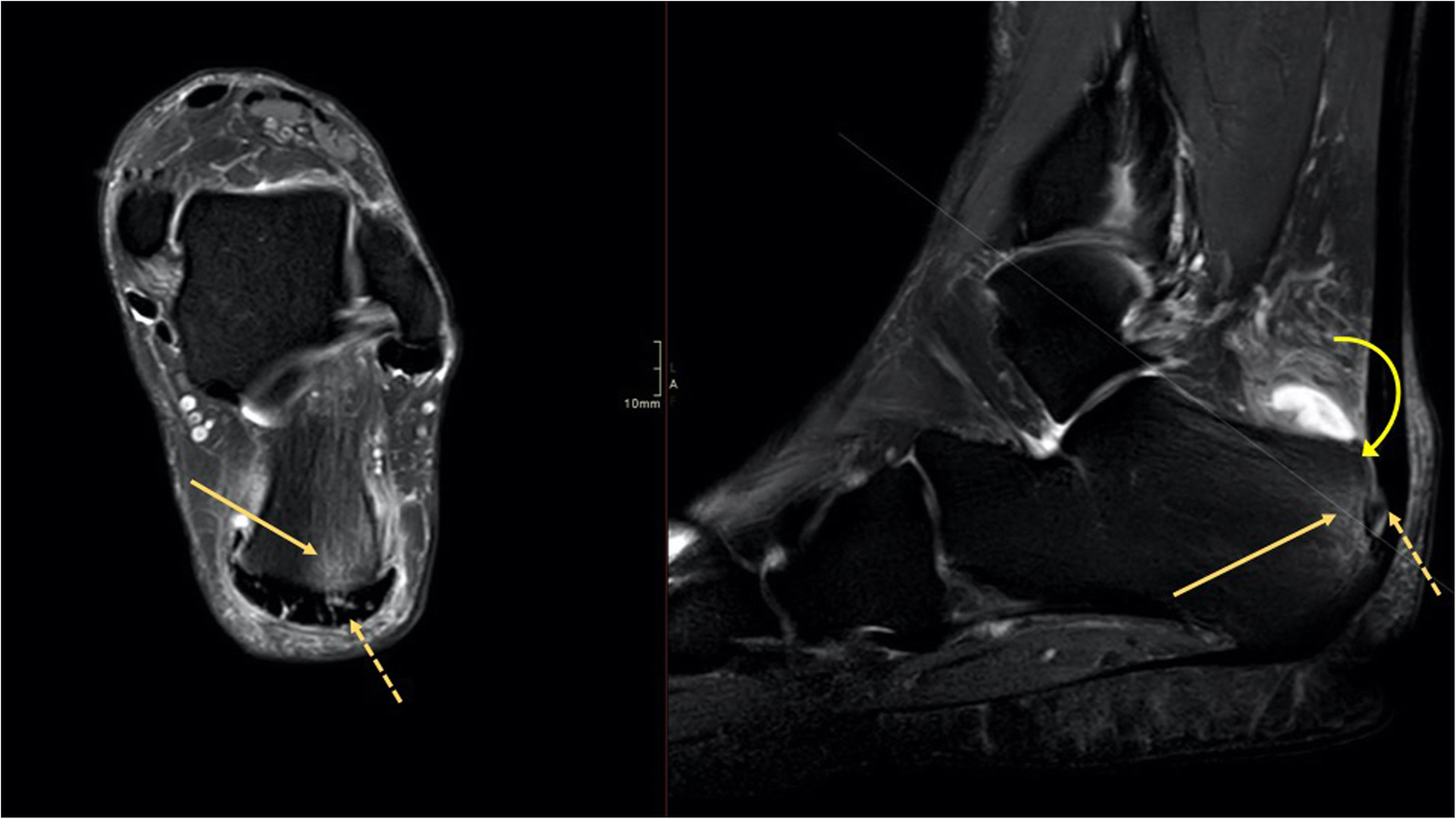 Fig. 10