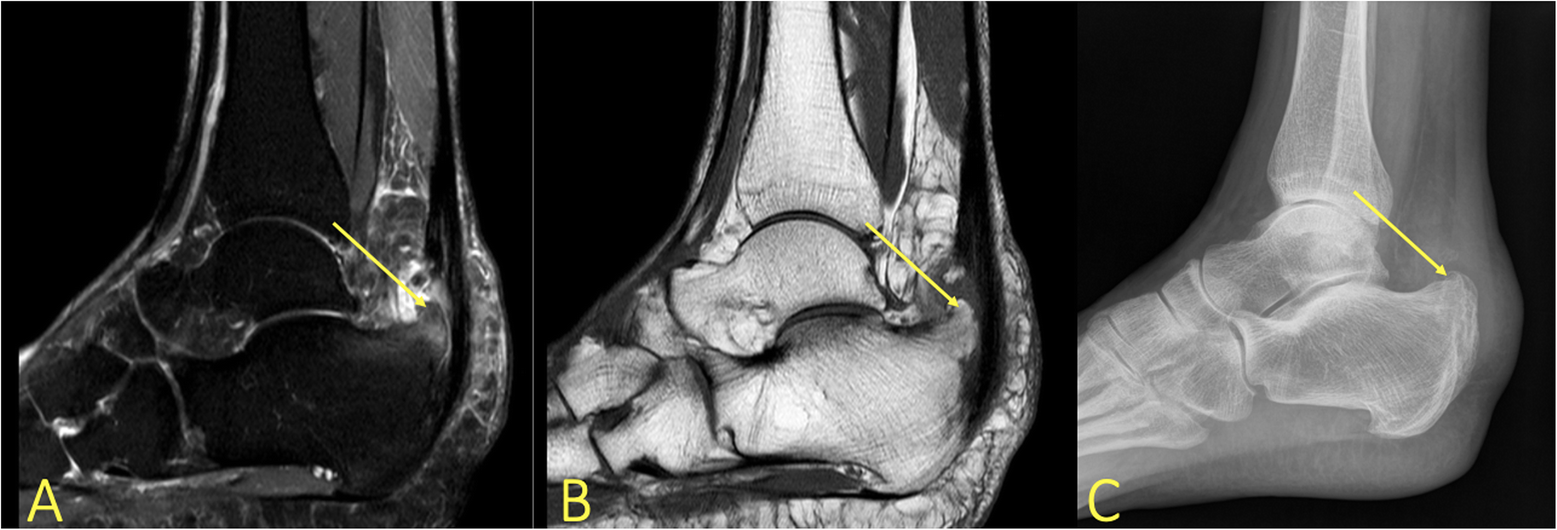 Fig. 11