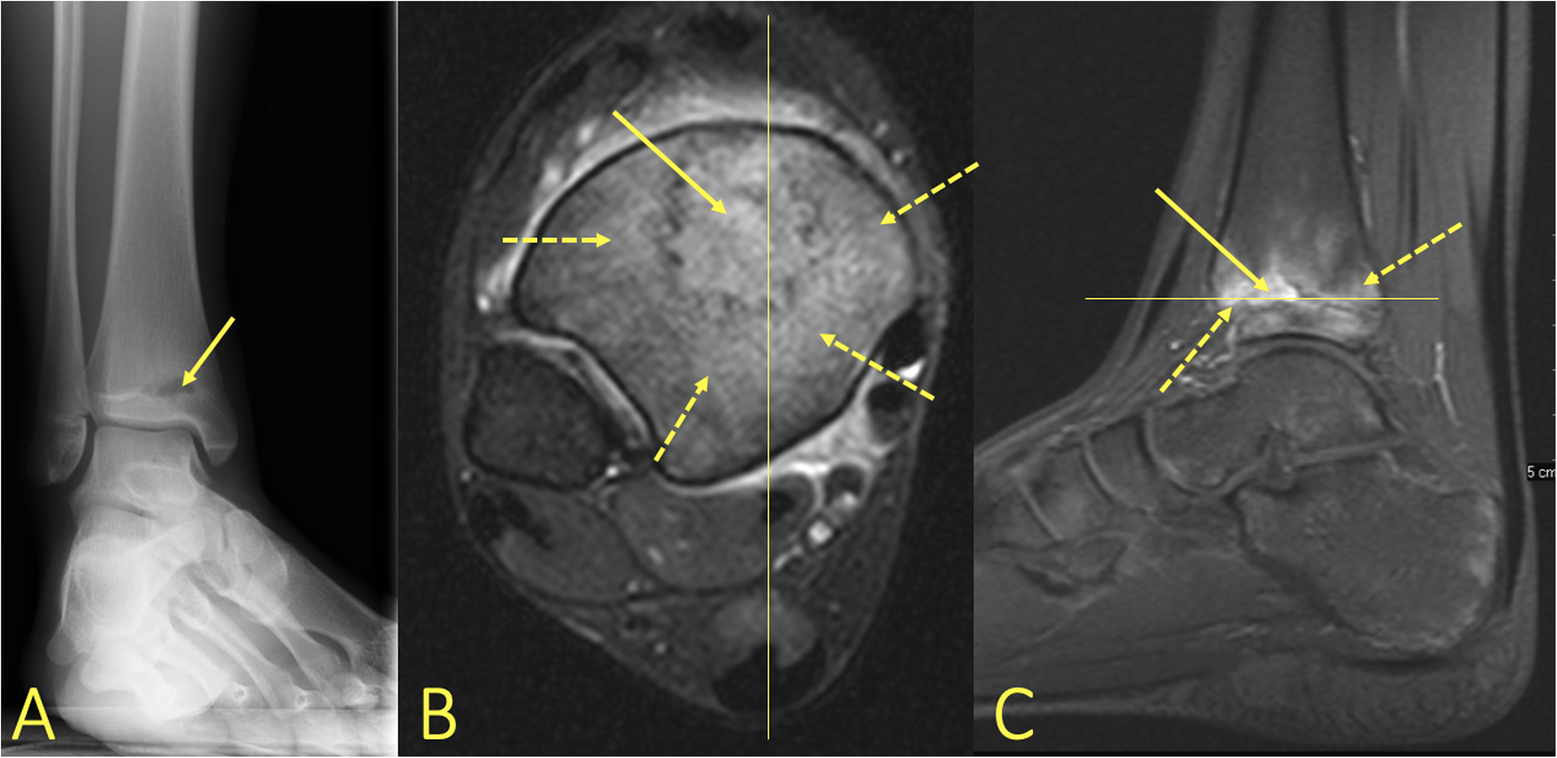 Fig. 26