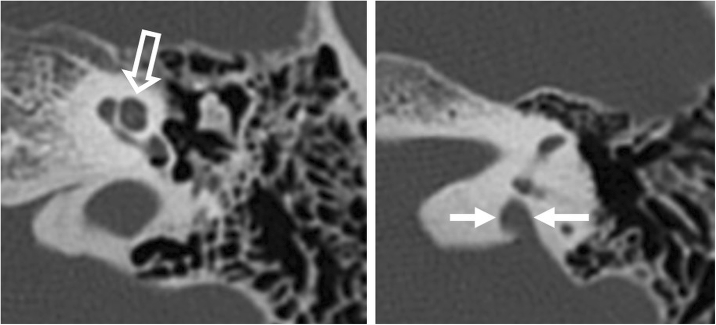 Fig. 11