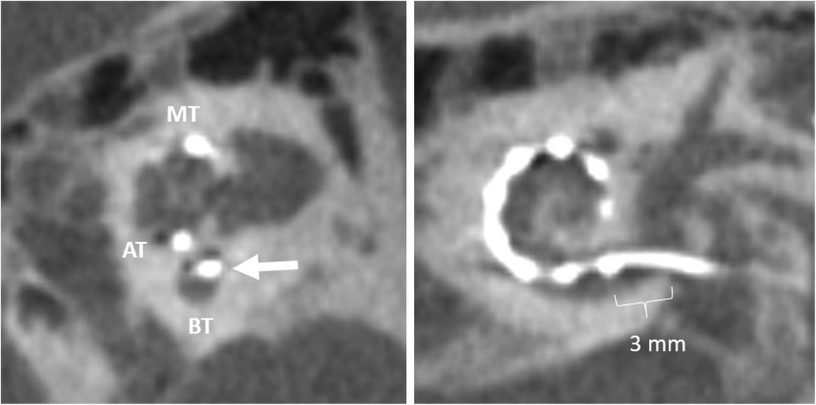 Fig. 20