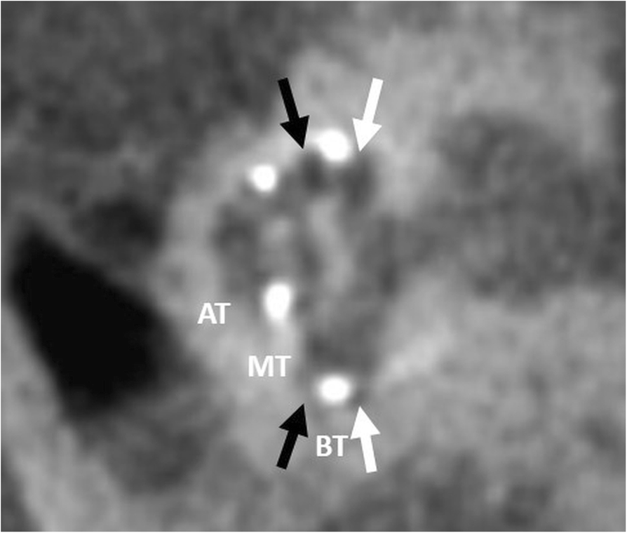 Fig. 23