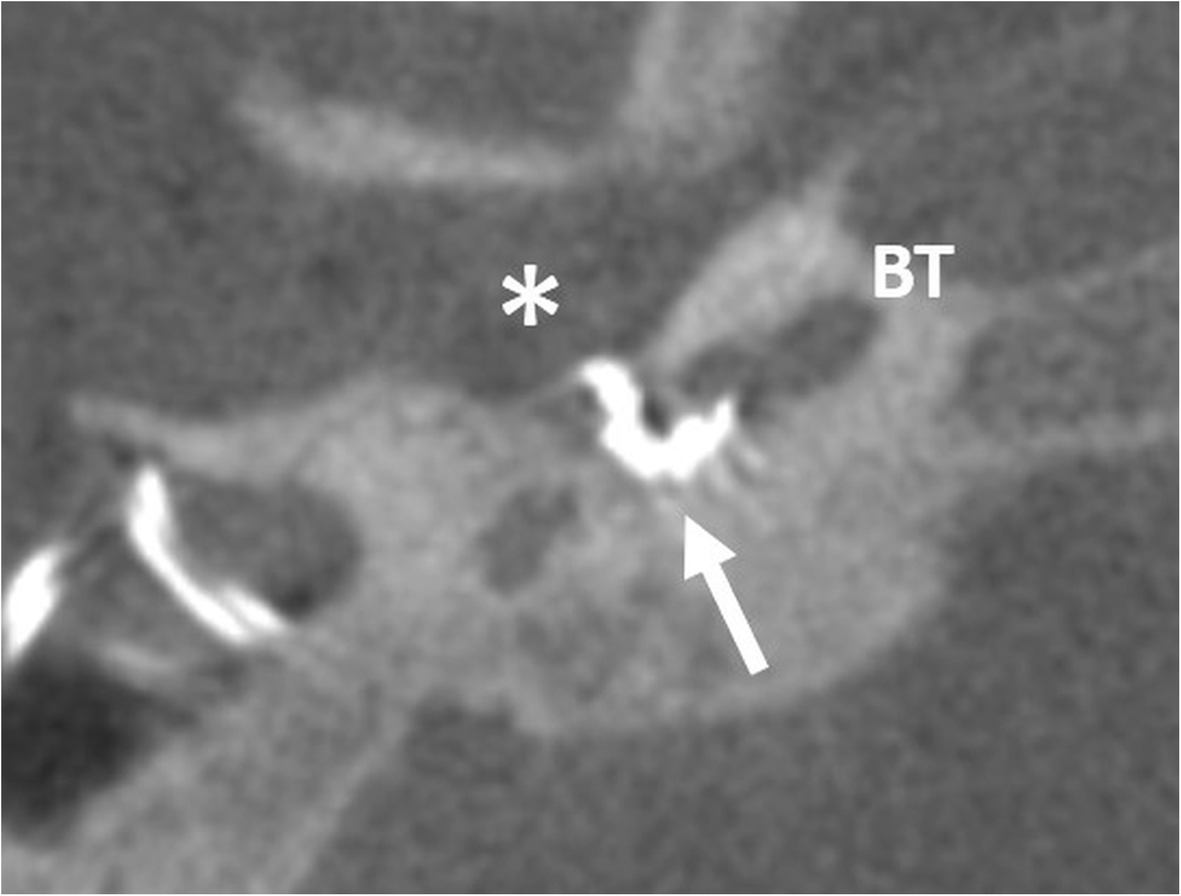 Fig. 31