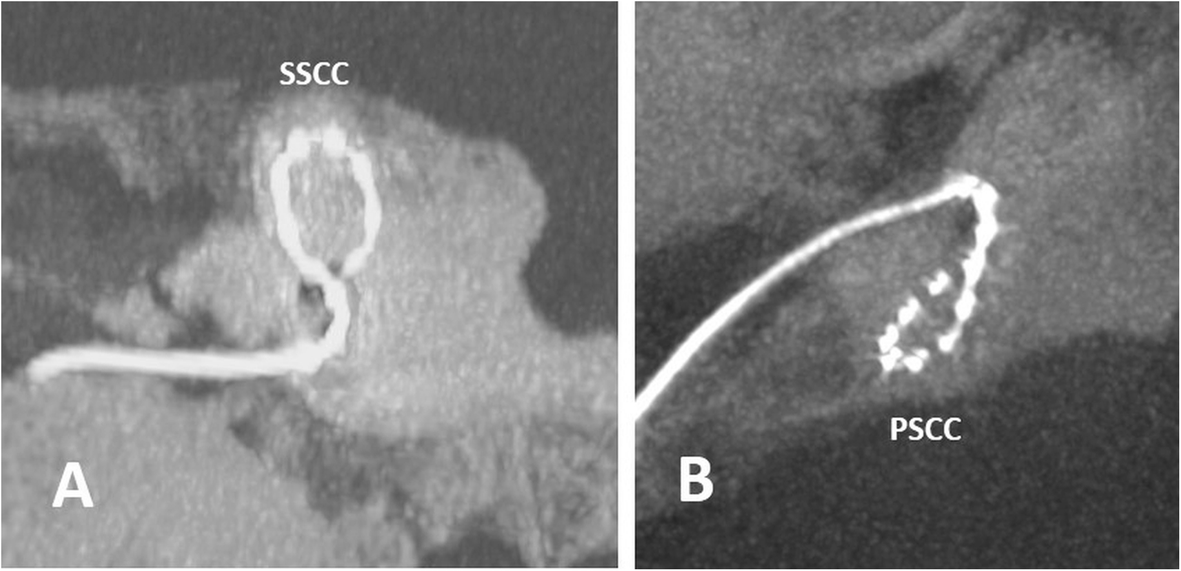 Fig. 33