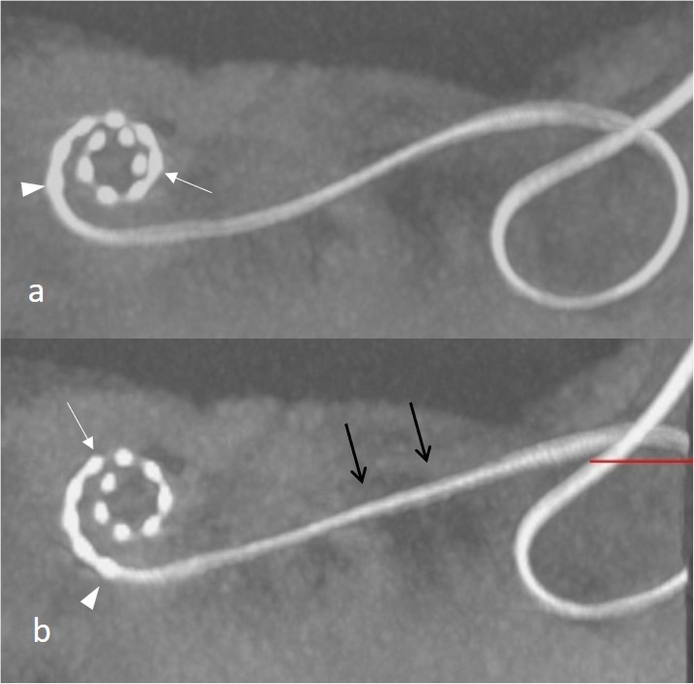 Fig. 34