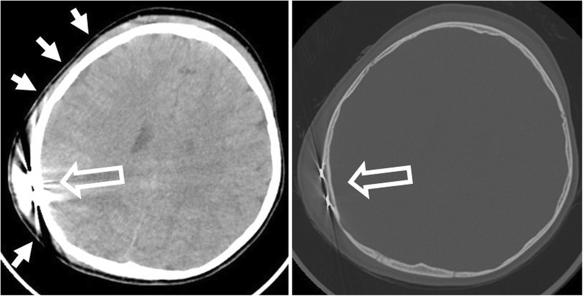 Fig. 35