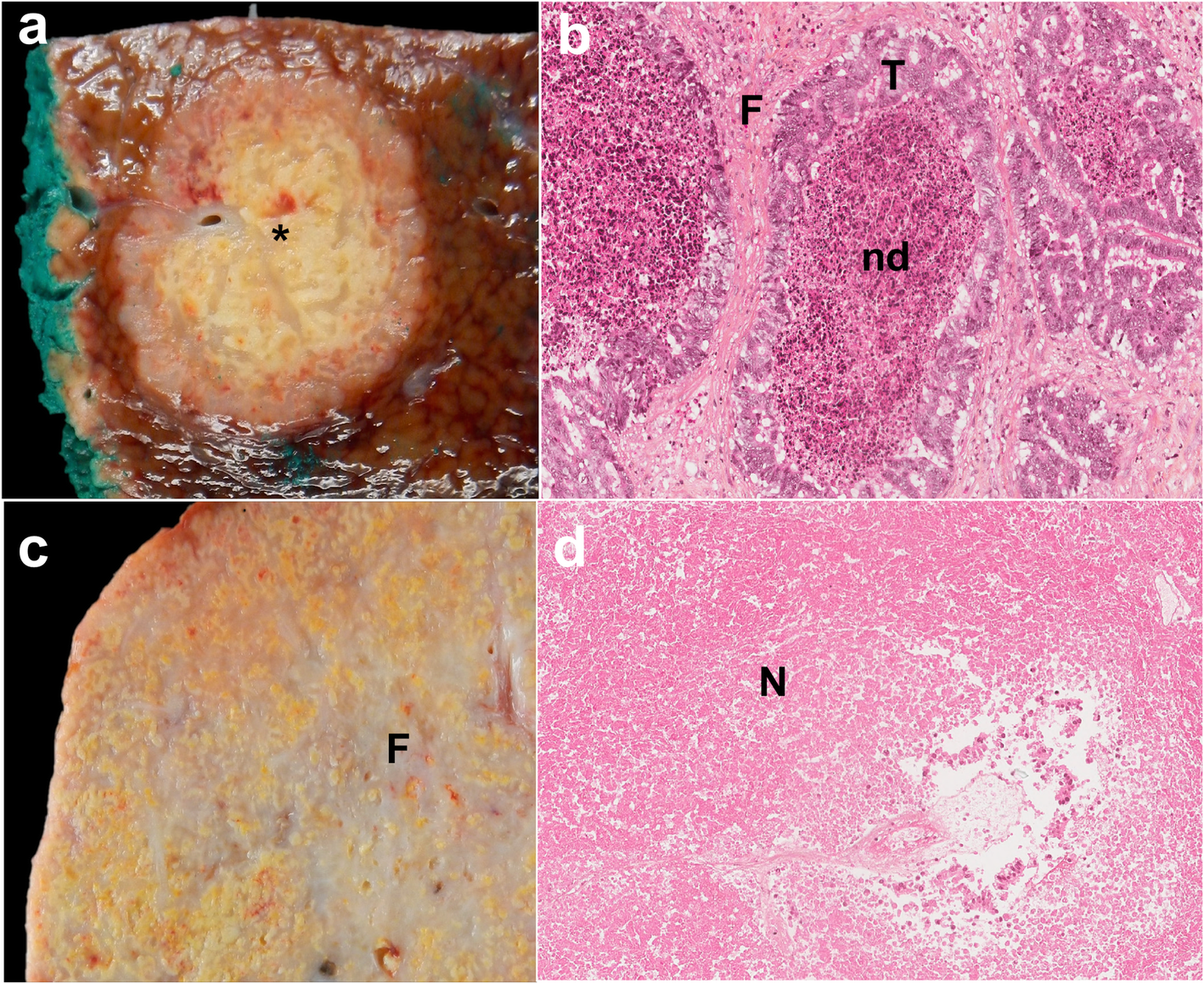 Fig. 12