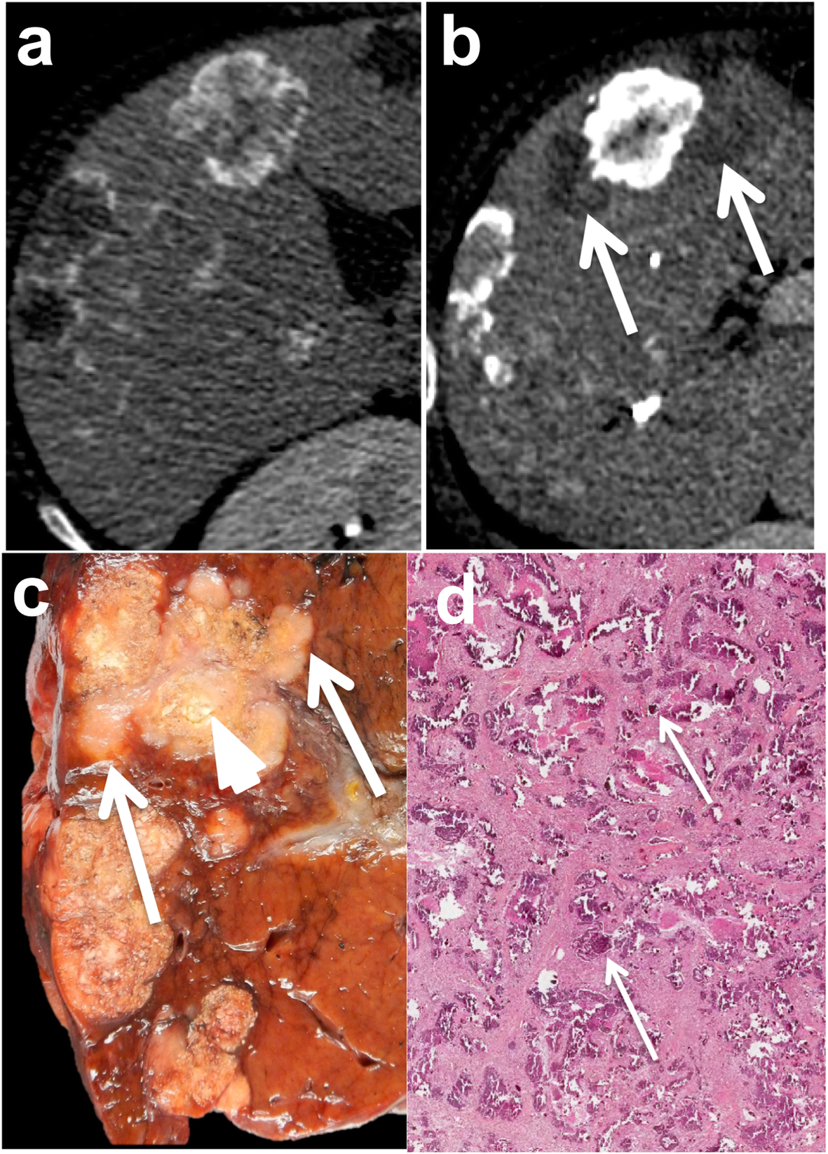 Fig. 14