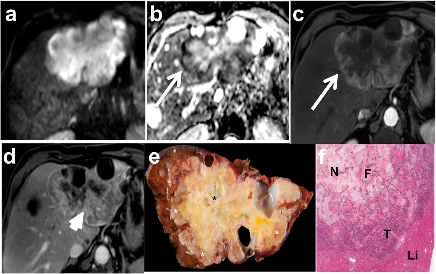 Fig. 15