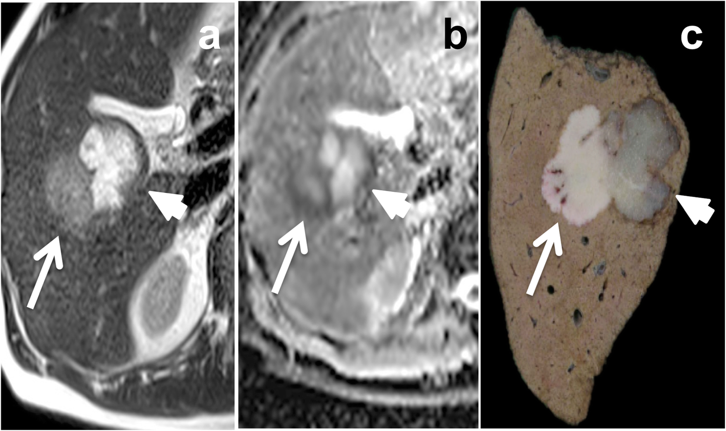 Fig. 16