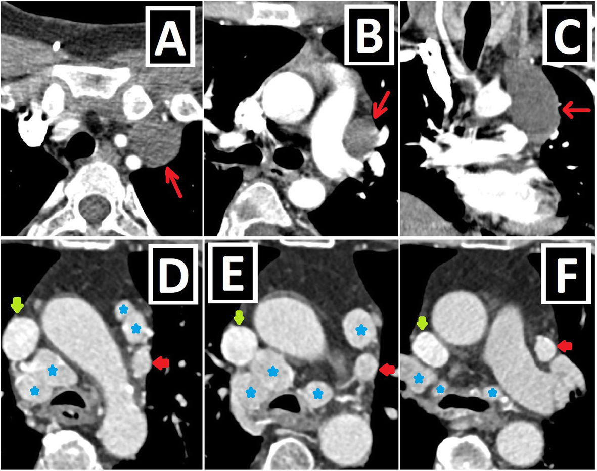 Fig. 16