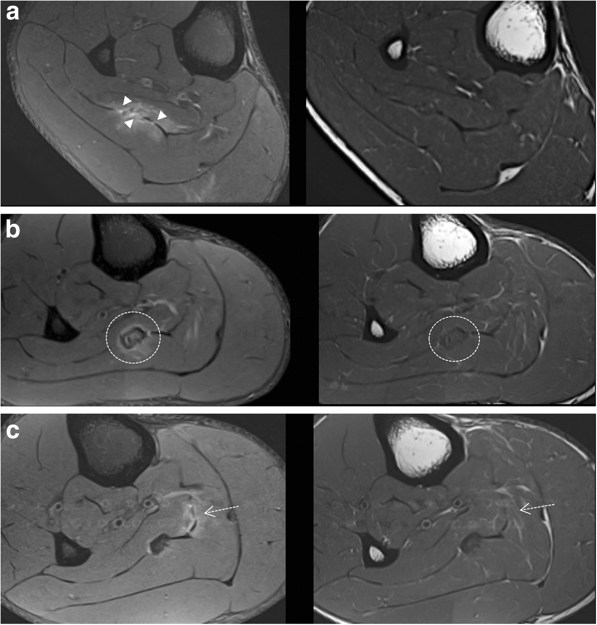 Fig. 13