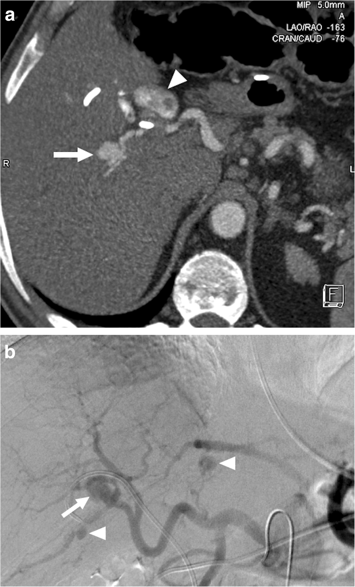 Fig. 10