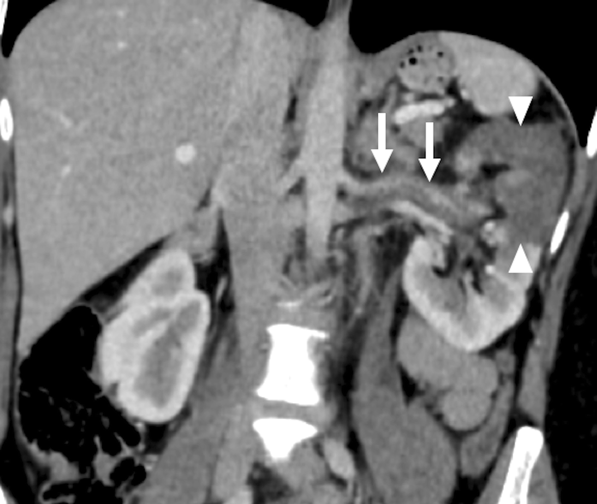 Fig. 11