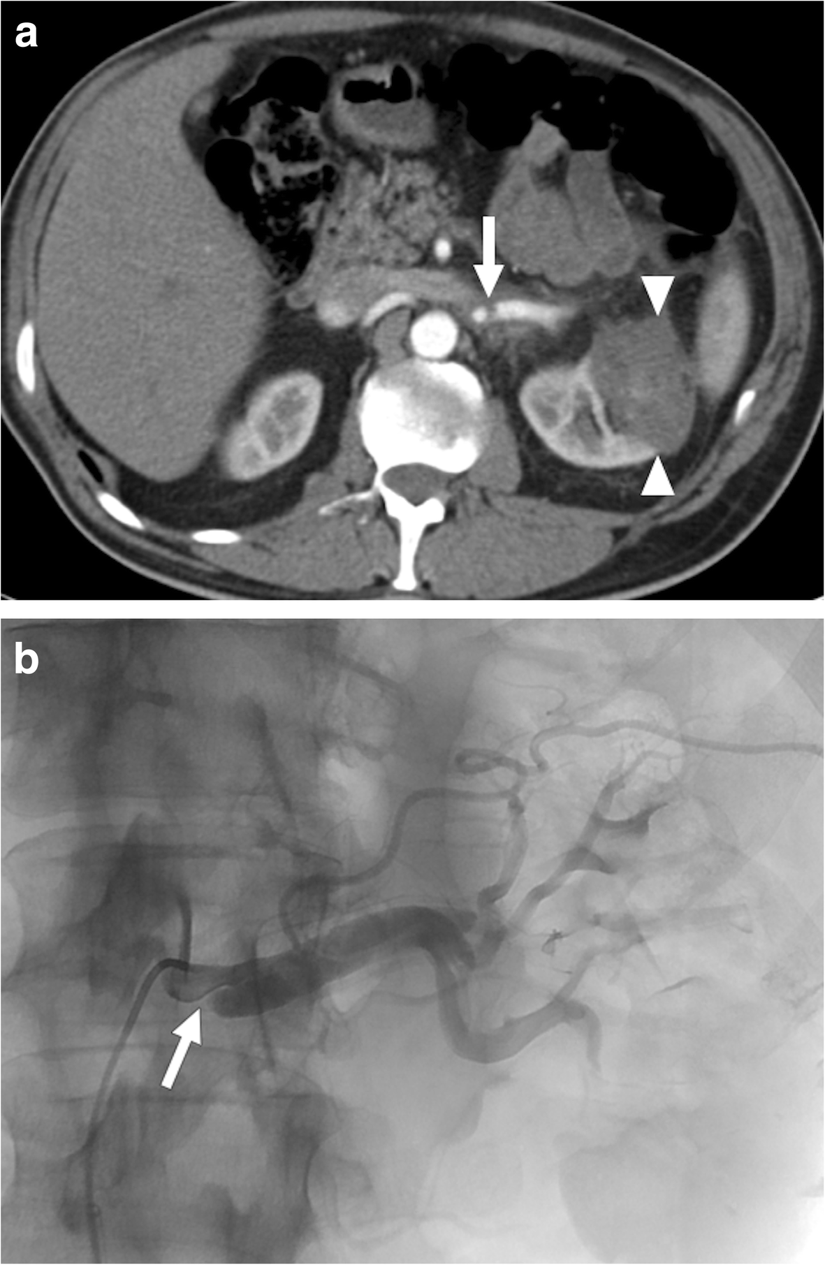 Fig. 12