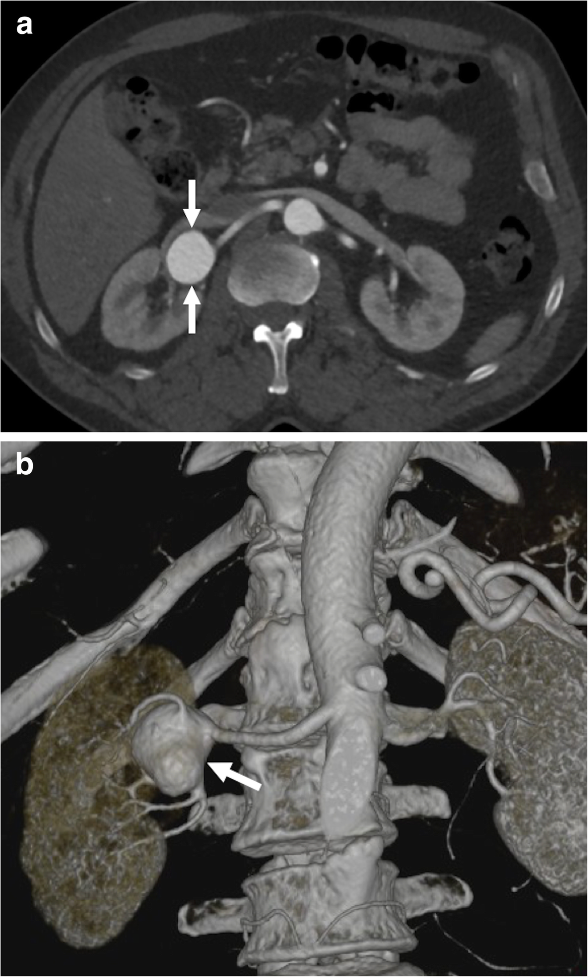 Fig. 13