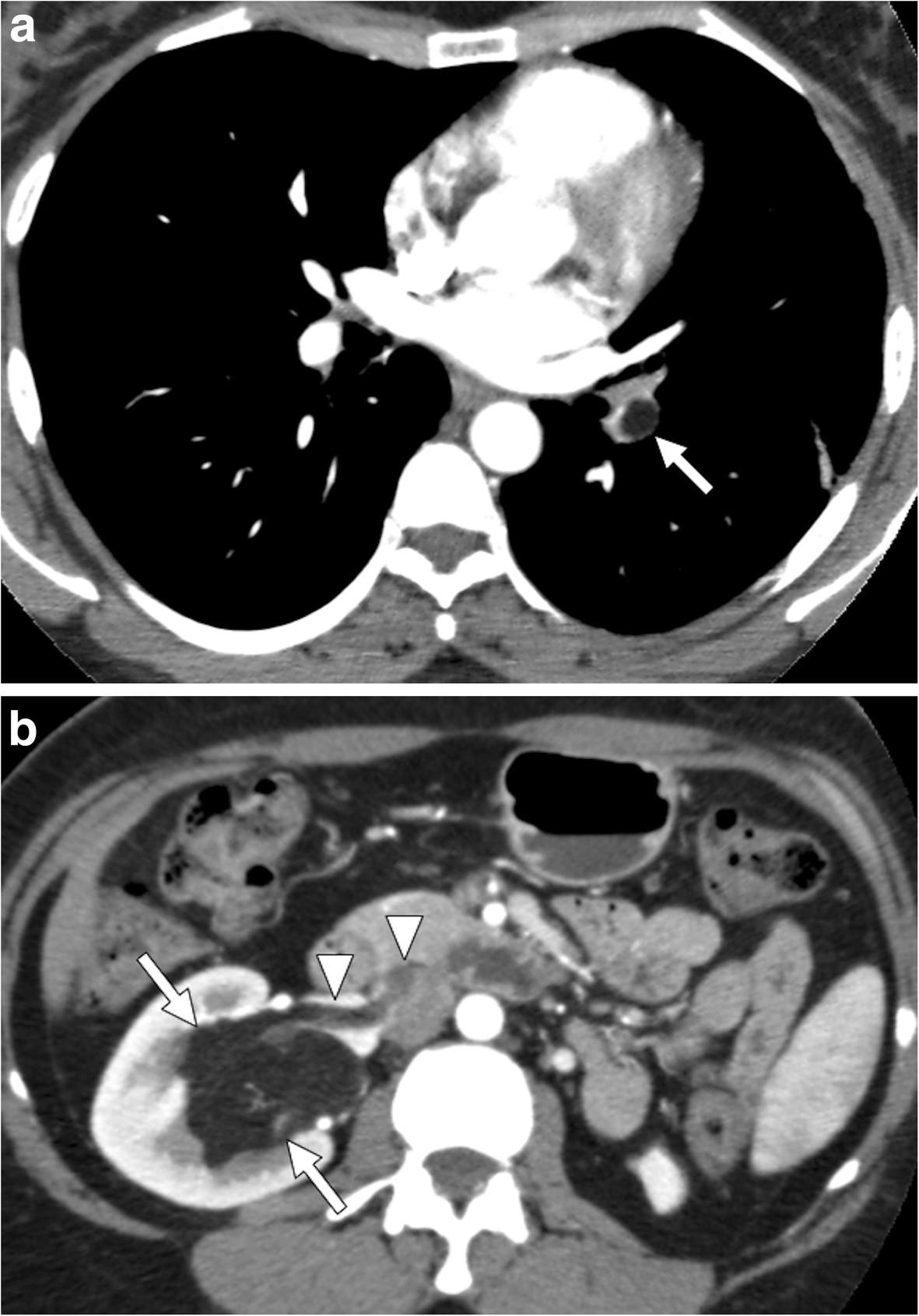 Fig. 17