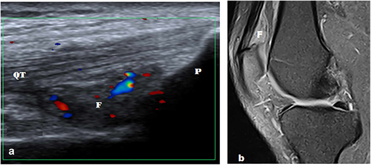 Fig. 10