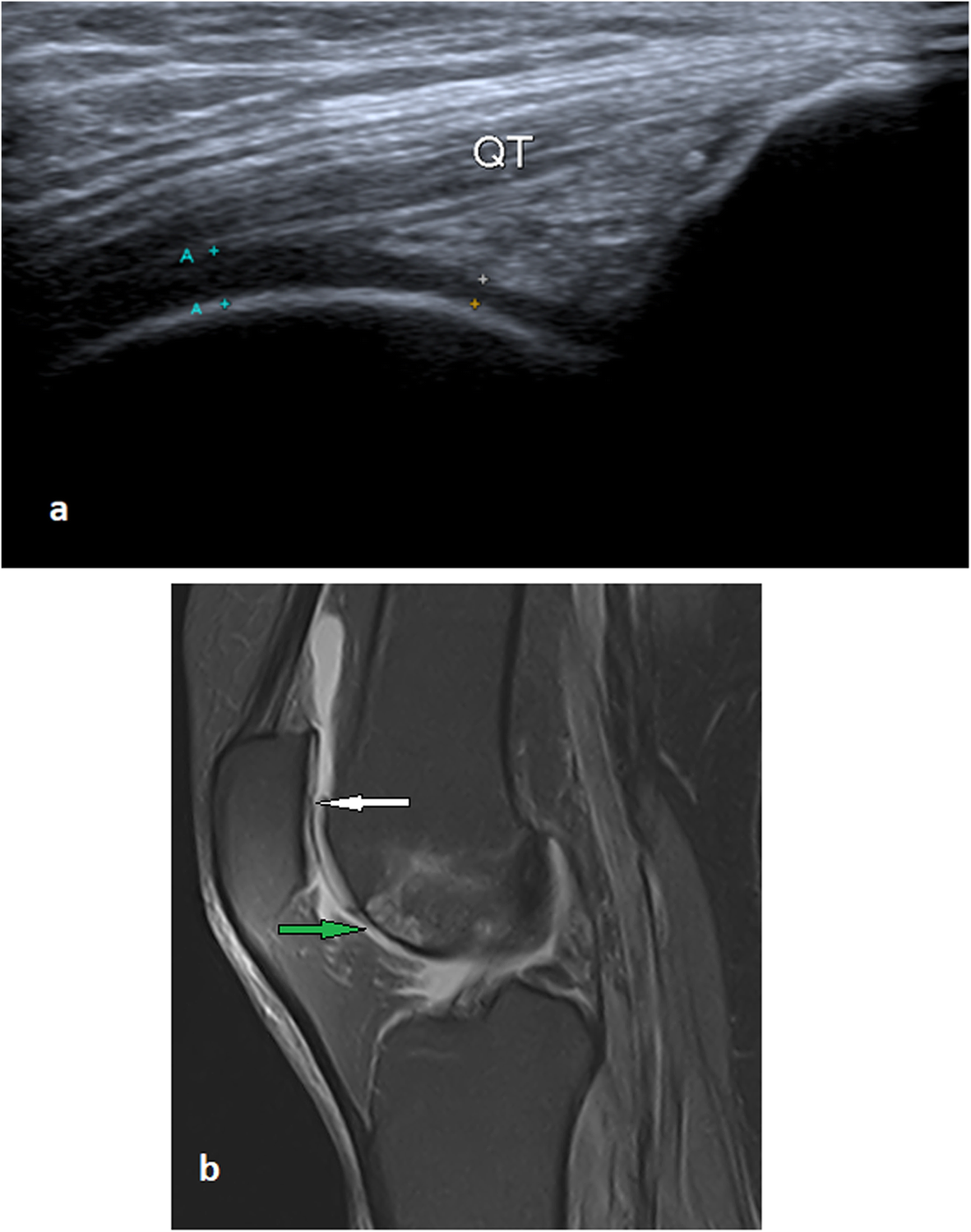 Fig. 6