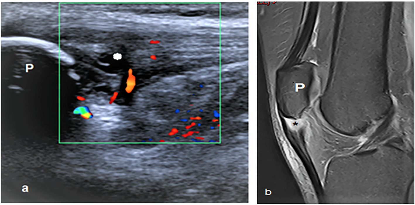 Fig. 9