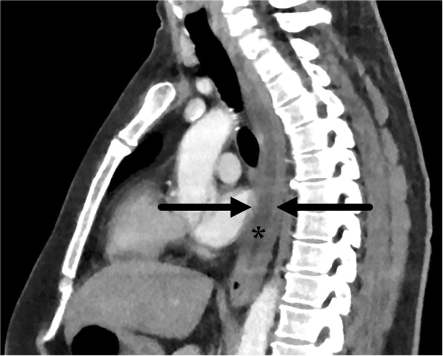 Fig. 10