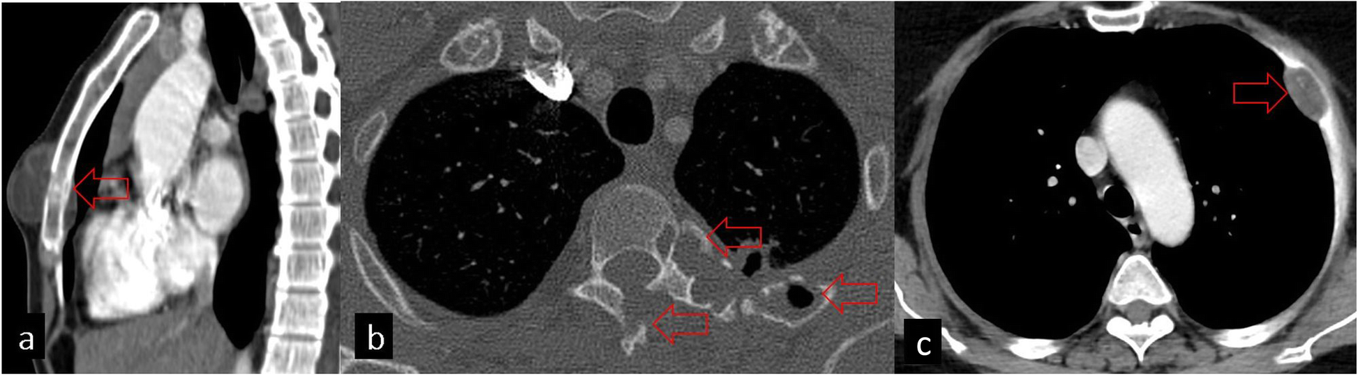 Fig. 11