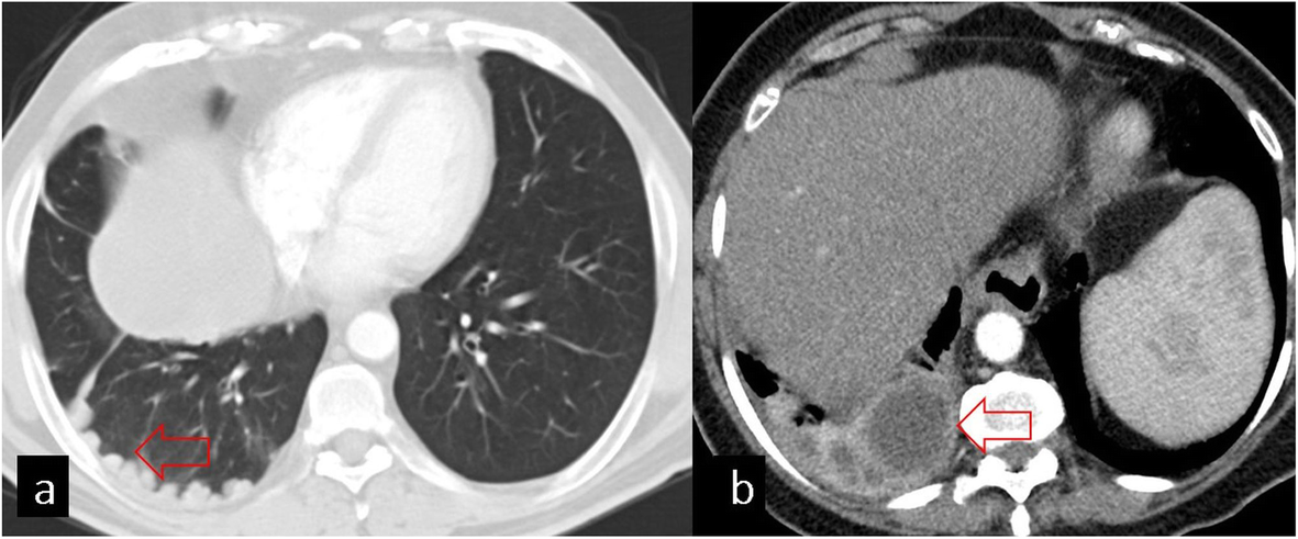 Fig. 13