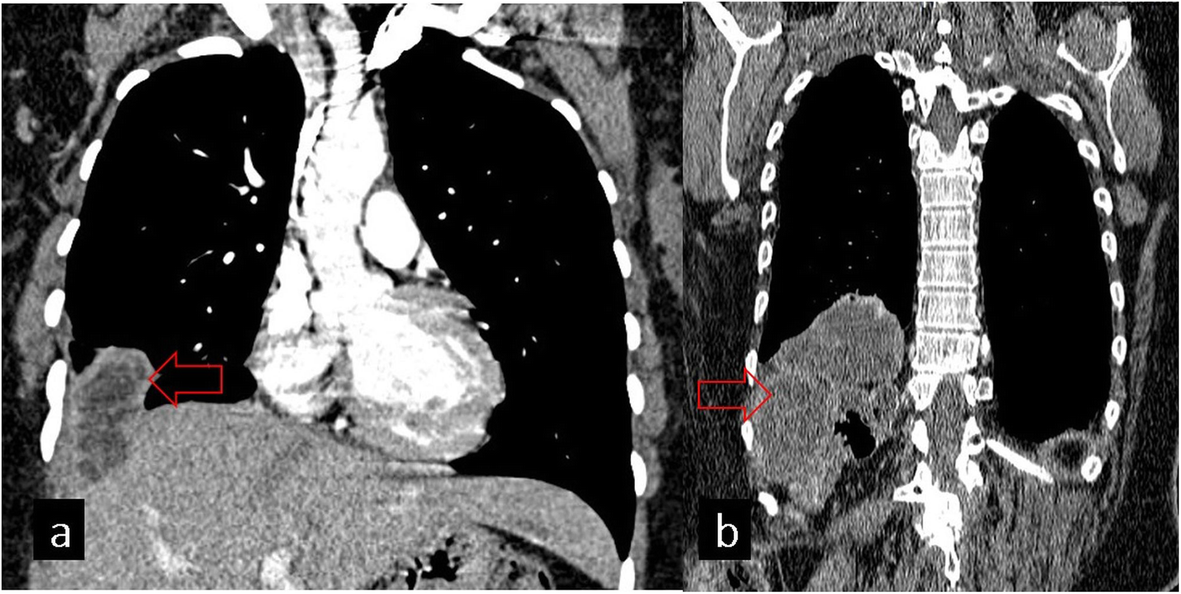 Fig. 14