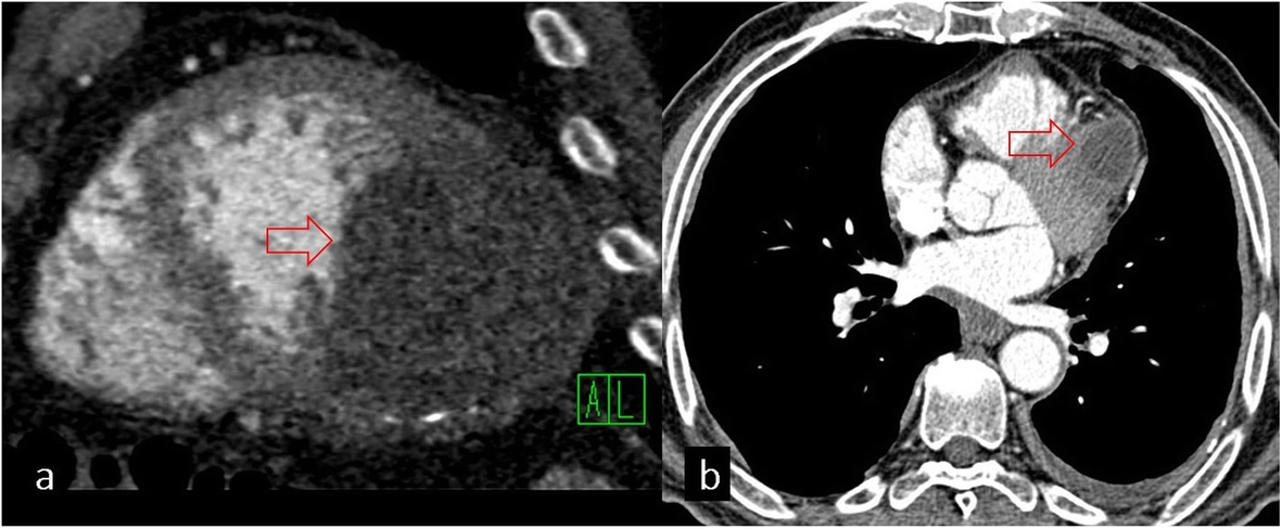 Fig. 16