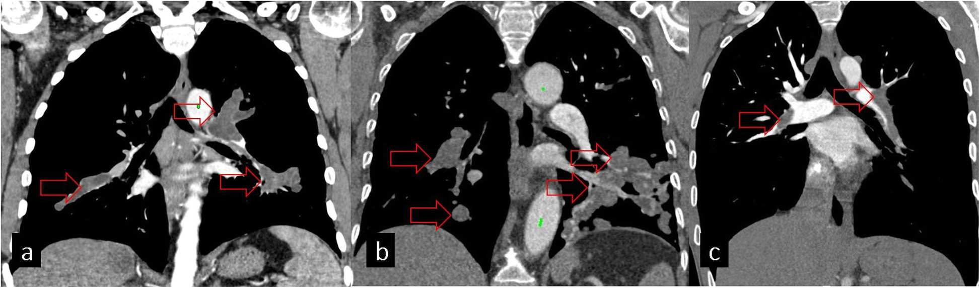 Fig. 17