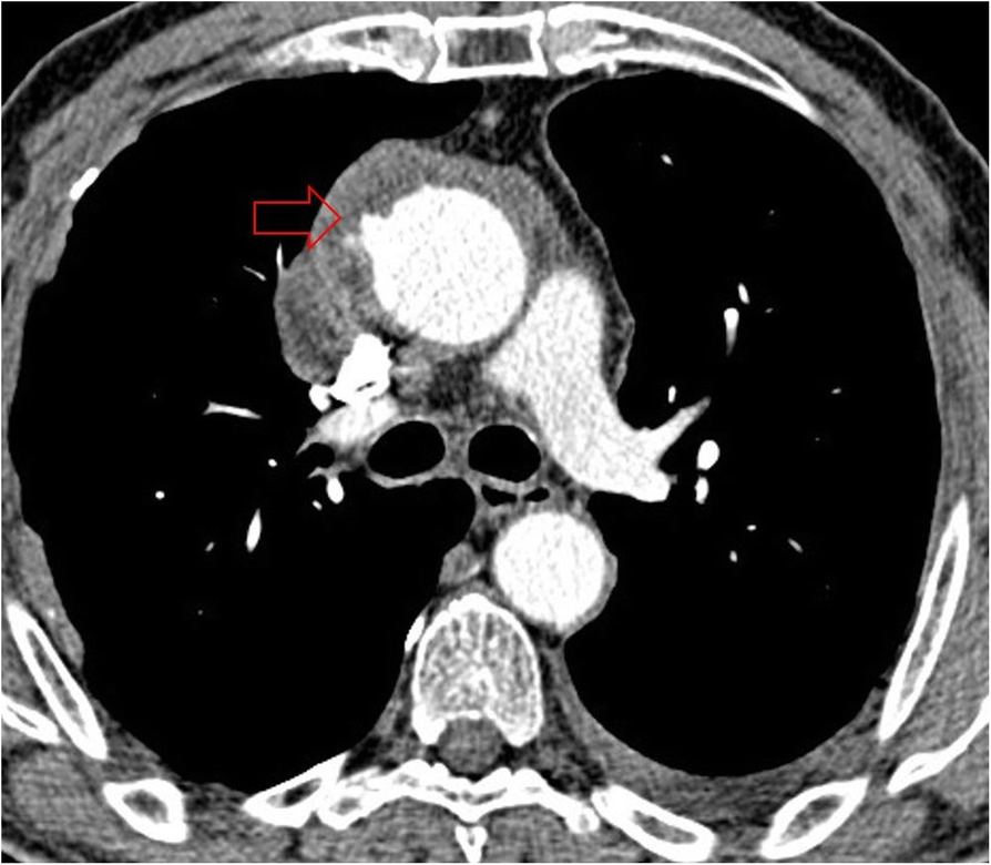 Fig. 18