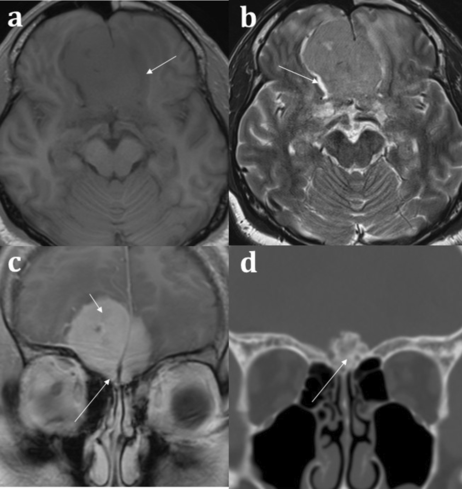 Fig. 13