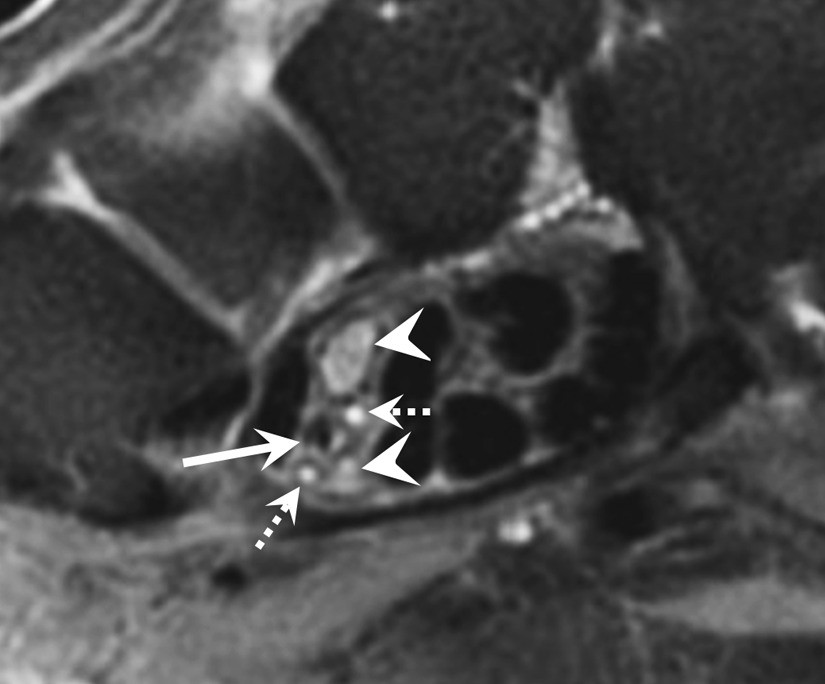 Fig. 13