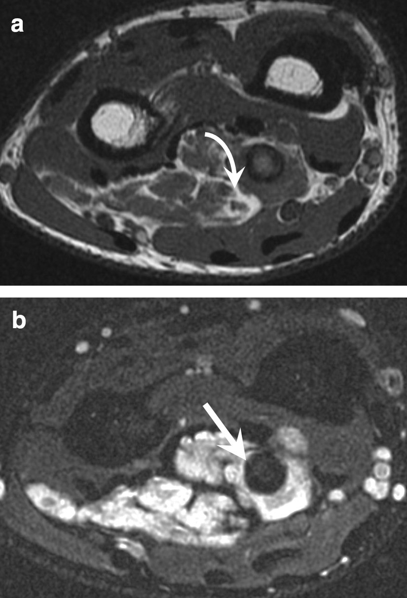 Fig. 16