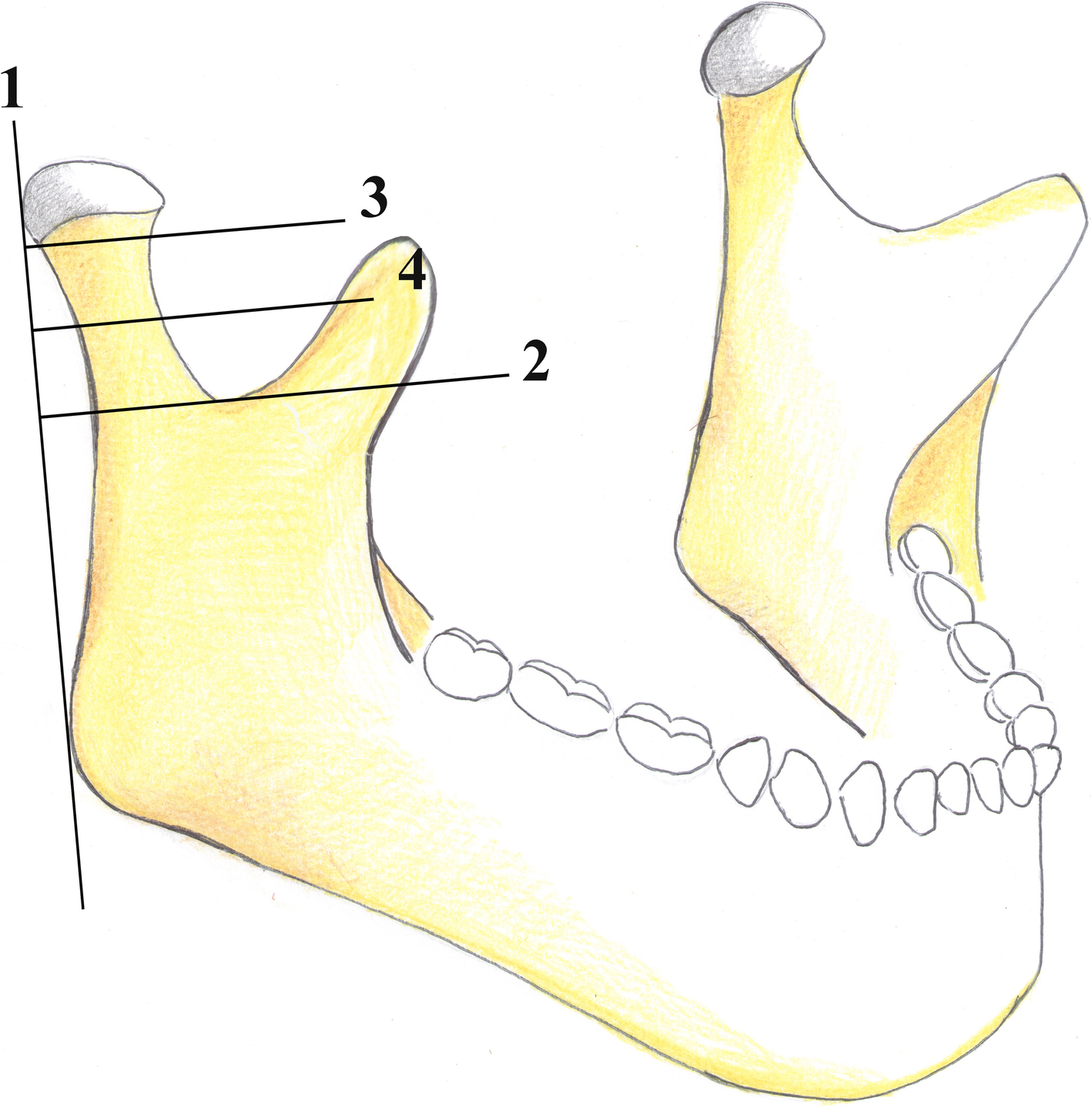 Fig. 12