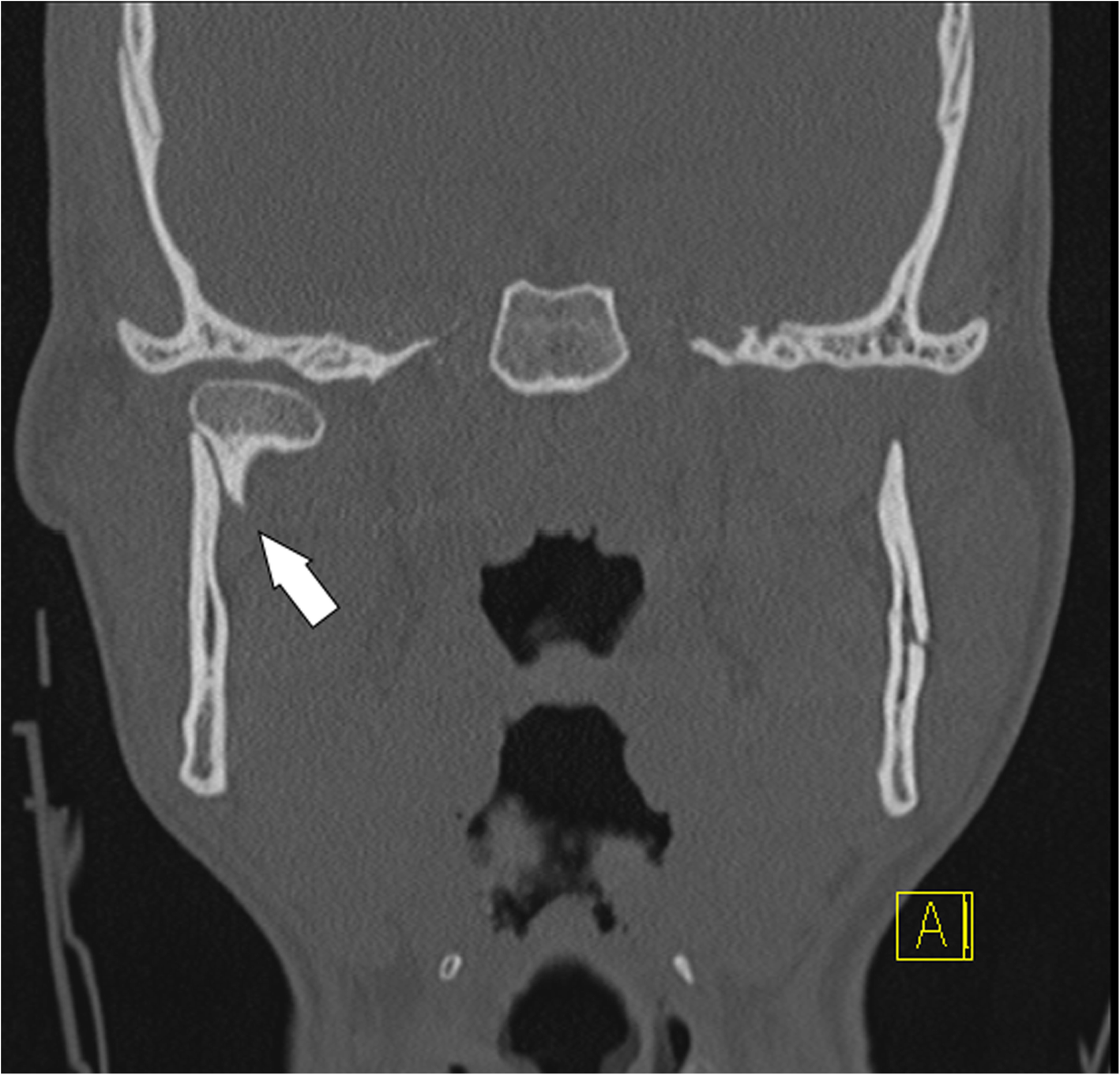 Fig. 15